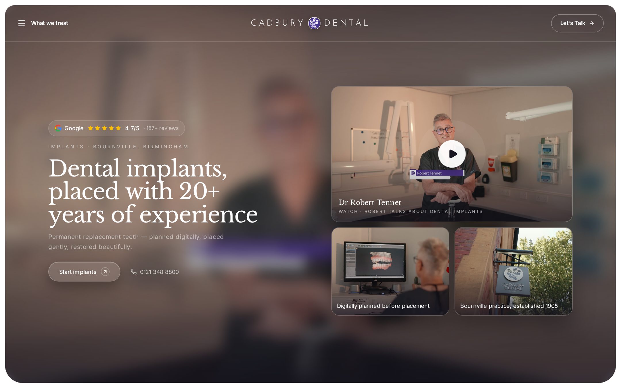 Cadbury Dental website: /dental-implants